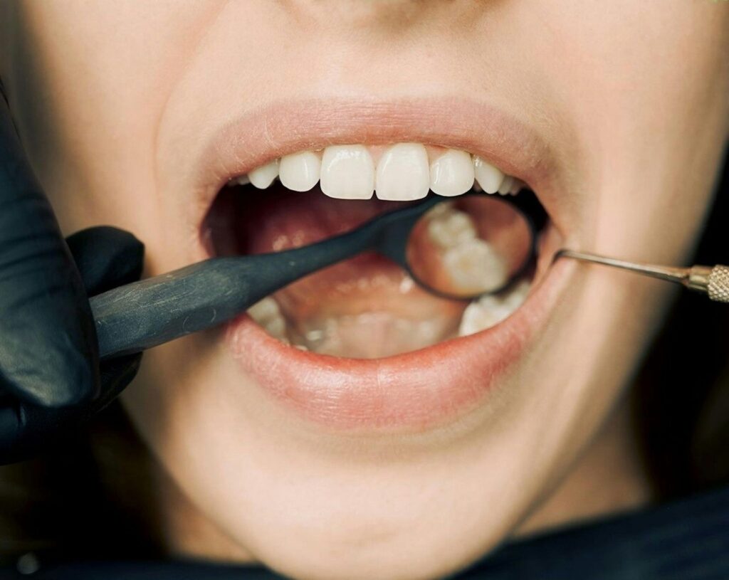 SolSmile Lounge | Restore Your Smile with Dental Bridges in Tampa, FL SolSmile Lounge | Restore Your Smile with Dental Bridges in Tampa, FL