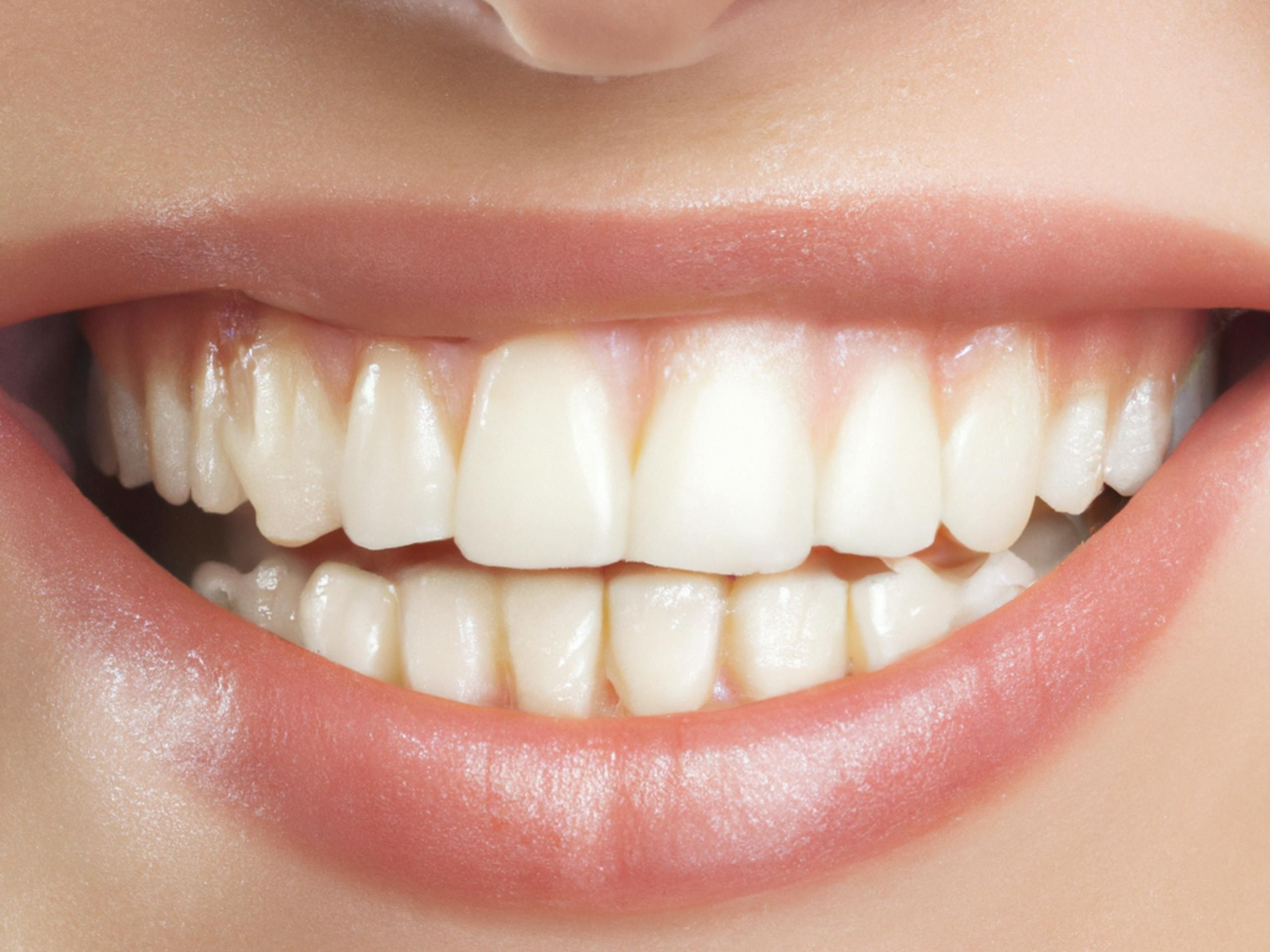 SolSmile Lounge | Cosmetic Dentistry in New Tampa: Your Path to a Confident Smile Starts at SolSmile Lounge