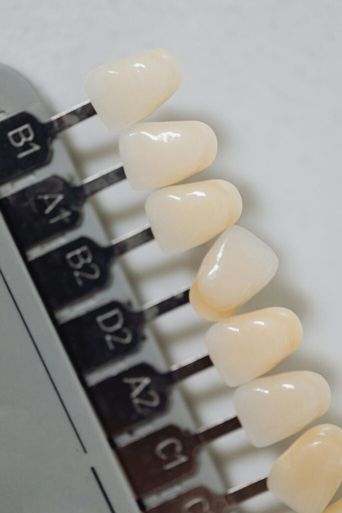SolSmile Lounge | Veneers 101: Are They Right for You