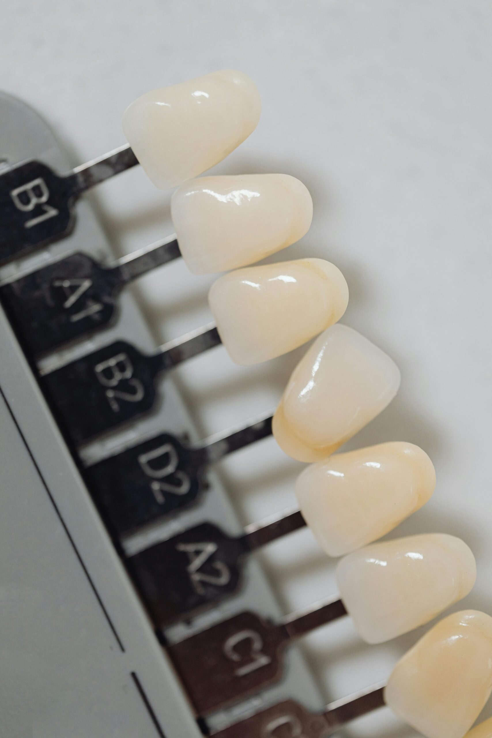 SolSmile Lounge | Veneers 101: Are They Right for You