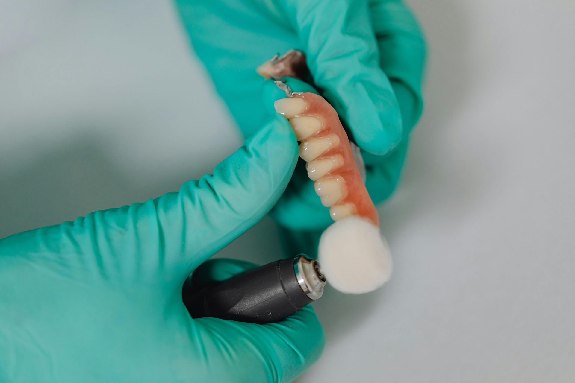 SolSmile Lounge | Dental Implants vs Dentures: What’s the Best Option in New Tampa?